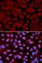 O-Linked N-Acetylglucosamine (GlcNAc) Transferase antibody, 18-433, ProSci, Immunofluorescence image 