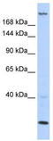 Trinucleotide Repeat Containing Adaptor 6B antibody, TA343824, Origene, Western Blot image 