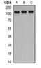 LY6/PLAUR Domain Containing 1 antibody, orb78460, Biorbyt, Western Blot image 