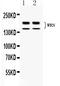 WRN RecQ Like Helicase antibody, PB10107, Boster Biological Technology, Western Blot image 
