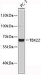 T-Box 22 antibody, 19-448, ProSci, Western Blot image 