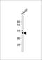 Potassium Voltage-Gated Channel Subfamily J Member 2 antibody, GTX81647, GeneTex, Western Blot image 