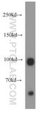 Guanylate Cyclase 2D, Retinal antibody, 55127-1-AP, Proteintech Group, Western Blot image 