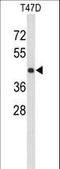 Potassium Channel Tetramerization Domain Containing 12 antibody, LS-C165456, Lifespan Biosciences, Western Blot image 