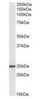 NBL1, DAN Family BMP Antagonist antibody, orb137174, Biorbyt, Western Blot image 