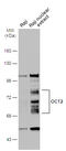 POU Class 2 Homeobox 2 antibody, GTX133723, GeneTex, Western Blot image 