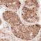 LIM Domain 7 antibody, HPA020923, Atlas Antibodies, Immunohistochemistry frozen image 