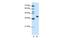 Heterogeneous Nuclear Ribonucleoprotein A3 antibody, GTX47187, GeneTex, Western Blot image 
