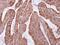 O-Sialoglycoprotein Endopeptidase antibody, PA5-21697, Invitrogen Antibodies, Immunohistochemistry paraffin image 