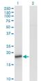 Synuclein Alpha antibody, H00006622-M01, Novus Biologicals, Western Blot image 