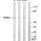 G Protein-Coupled Receptor Kinase 6 antibody, A03623, Boster Biological Technology, Western Blot image 