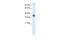 Zinc finger protein 654 antibody, 27-796, ProSci, Western Blot image 