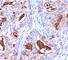 Carcinoembryonic Antigen Related Cell Adhesion Molecule 5 antibody, V2090IHC-7ML, NSJ Bioreagents, Immunohistochemistry frozen image 