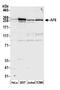 Afadin, Adherens Junction Formation Factor antibody, A302-199A, Bethyl Labs, Western Blot image 