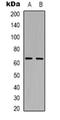 Arylsulfatase Family Member I antibody, orb318996, Biorbyt, Western Blot image 