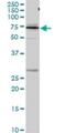 Kininogen 1 antibody, H00003827-D01P, Novus Biologicals, Western Blot image 