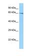 Arachidonate 5-Lipoxygenase antibody, orb331210, Biorbyt, Western Blot image 