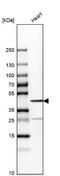 Troponin T2, Cardiac Type antibody, NBP1-88069, Novus Biologicals, Western Blot image 