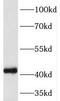 N-Terminal EF-Hand Calcium Binding Protein 3 antibody, FNab05640, FineTest, Western Blot image 