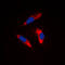 Integrin Subunit Beta 3 antibody, LS-C352409, Lifespan Biosciences, Immunofluorescence image 