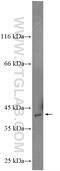 Spermine Synthase antibody, 15979-1-AP, Proteintech Group, Western Blot image 