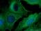 RAB38, Member RAS Oncogene Family antibody, 12234-1-AP, Proteintech Group, Immunofluorescence image 