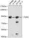 Transglutaminase 2 antibody, GTX32934, GeneTex, Western Blot image 