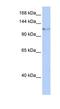 Helicase, Lymphoid Specific antibody, NBP1-57145, Novus Biologicals, Western Blot image 