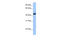 KH RNA Binding Domain Containing, Signal Transduction Associated 1 antibody, 29-386, ProSci, Enzyme Linked Immunosorbent Assay image 