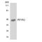 Solute carrier family 52, riboflavin transporter, member 1 antibody, LS-C200481, Lifespan Biosciences, Western Blot image 