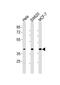 Hepsin antibody, M02350, Boster Biological Technology, Western Blot image 