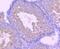 Androgen Receptor antibody, NBP2-67497, Novus Biologicals, Immunohistochemistry paraffin image 