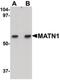 Matrilin 1 antibody, PA5-20724, Invitrogen Antibodies, Western Blot image 