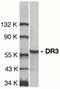 TNF Receptor Superfamily Member 25 antibody, PA5-19886, Invitrogen Antibodies, Western Blot image 