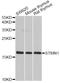 Stathmin 1 antibody, A2176, ABclonal Technology, Western Blot image 