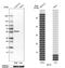 Alanine aminotransferase 2 antibody, NBP2-14072, Novus Biologicals, Western Blot image 