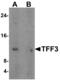 Trefoil Factor 3 antibody, MBS150083, MyBioSource, Western Blot image 