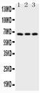TNF Receptor Superfamily Member 8 antibody, RP1029, Boster Biological Technology, Western Blot image 