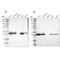 Armadillo Repeat Containing 10 antibody, PA5-52783, Invitrogen Antibodies, Western Blot image 