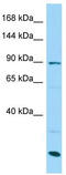 Signal Peptide, CUB Domain And EGF Like Domain Containing 3 antibody, TA331293, Origene, Western Blot image 