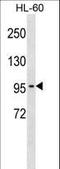 Chloride Voltage-Gated Channel 2 antibody, LS-C168805, Lifespan Biosciences, Western Blot image 