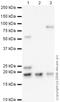 Twist Family BHLH Transcription Factor 2 antibody, ab66031, Abcam, Western Blot image 