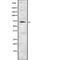 Regulator Of MON1-CCZ1 antibody, abx148734, Abbexa, Western Blot image 