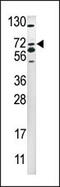 SMAD Specific E3 Ubiquitin Protein Ligase 2 antibody, MBS9205919, MyBioSource, Western Blot image 