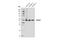 Sprouty Related EVH1 Domain Containing 1 antibody, 94063S, Cell Signaling Technology, Western Blot image 