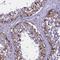 Ubl carboxyl-terminal hydrolase 18 antibody, NBP1-92566, Novus Biologicals, Immunohistochemistry paraffin image 