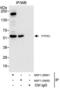 Protein Tyrosine Phosphatase Non-Receptor Type 1 antibody, NBP1-28691, Novus Biologicals, Immunoprecipitation image 
