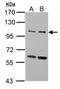 Unc-51 Like Autophagy Activating Kinase 2 antibody, LS-C186213, Lifespan Biosciences, Western Blot image 