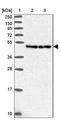 Serpin Family E Member 3 antibody, NBP2-14751, Novus Biologicals, Western Blot image 