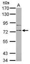 CD180 Molecule antibody, PA5-34695, Invitrogen Antibodies, Western Blot image 